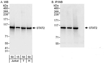 Rabbit anti-STAT2 Antibody