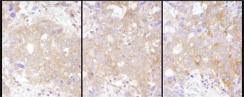 Rabbit anti-STAT2 Antibody