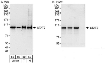 Rabbit anti-STAT2 Antibody