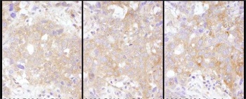 Rabbit anti-STAT2 Antibody