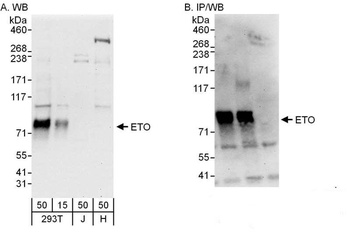 Rabbit ETO Antibody