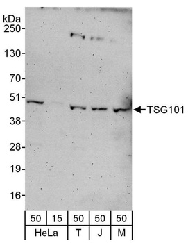 Rabbit TSG101 Antibody