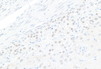 Rabbit anti-GATA4 Antibody