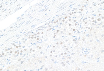 GATA4 Antibody