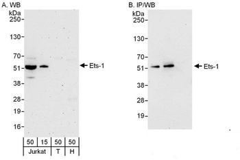 Rabbit Ets-1 Antibody