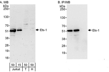 Rabbit Ets-1 Antibody