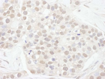 Rabbit anti-Cyclin T1 Antibody