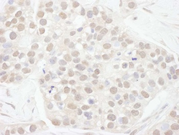 Cyclin T1 Antibody