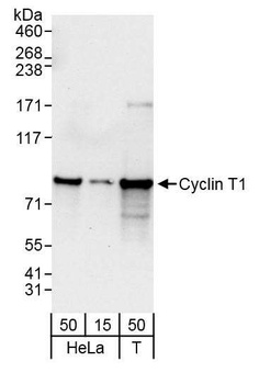 Rabbit anti-Cyclin T1 Antibody