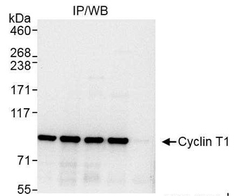 Rabbit anti-Cyclin T1 Antibody