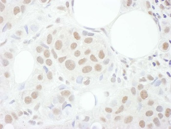 Rabbit anti-Cyclin T1 Antibody