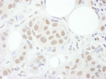 Cyclin T1 Antibody