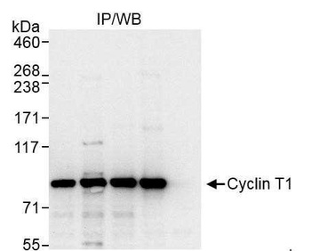 Rabbit anti-Cyclin T1 Antibody