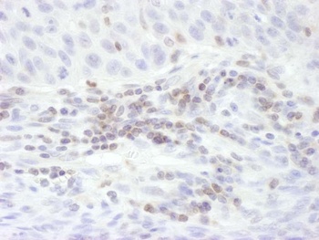 Rabbit STAT5b Antibody
