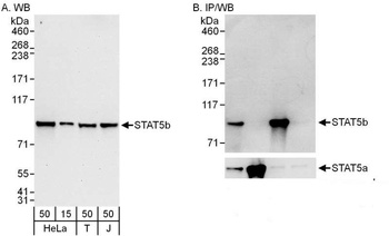 Rabbit STAT5b Antibody