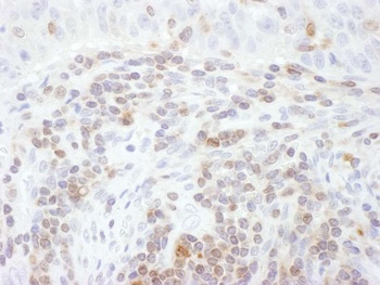 Rabbit STAT5a Antibody