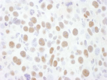 Rabbit anti-CDK9 Antibody