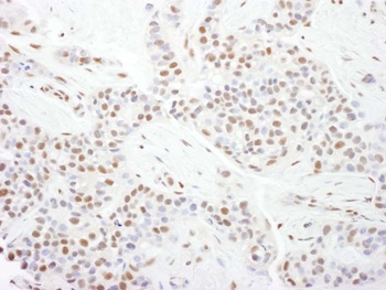 Rabbit anti-CDK9 Antibody