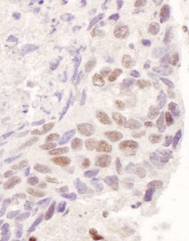 Rabbit GR Antibody