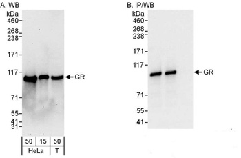 Rabbit GR Antibody