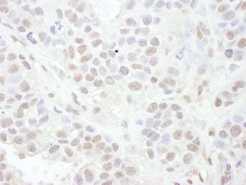 Rabbit LEF1 Antibody