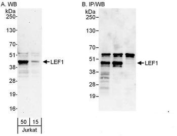 Rabbit LEF1 Antibody