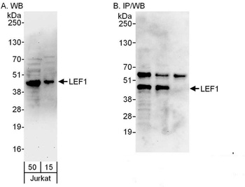 Rabbit LEF1 Antibody