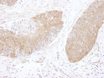 Rabbit anti-CCT5 Antibody