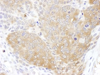 Rabbit anti-CCT5 Antibody