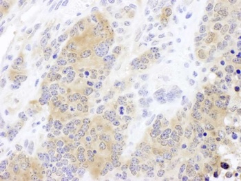 Rabbit anti-CCT2 Antibody