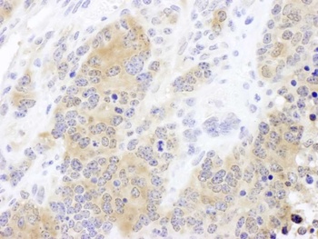 CCT2 Antibody