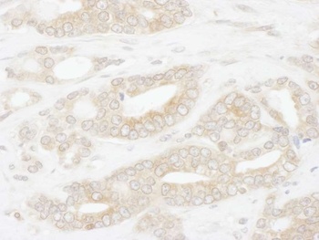 Rabbit anti-CCT2 Antibody