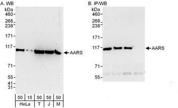 Rabbit AARS Antibody