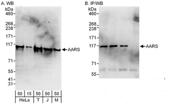 Rabbit AARS Antibody