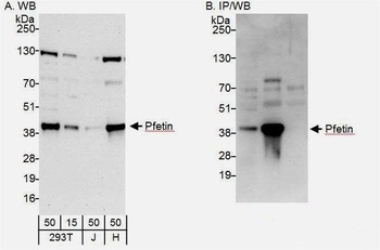 Rabbit Pfetin Antibody
