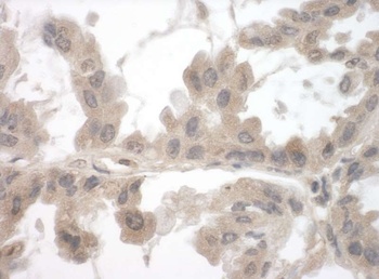 Rabbit anti-Toca-1 Antibody