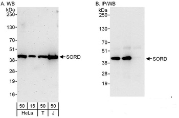 Rabbit SORD Antibody