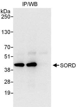 Rabbit SORD Antibody