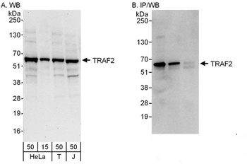 Rabbit TRAF2 Antibody