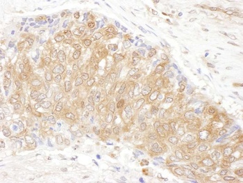 Rabbit anti-CCT3 Antibody