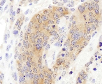 Rabbit anti-CCT3 Antibody