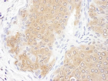 Rabbit anti-CCT3 Antibody