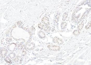 Rabbit anti-SNRNP200 Antibody
