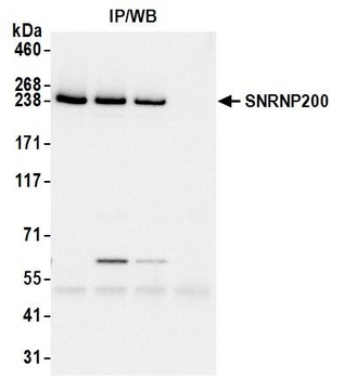 Rabbit anti-SNRNP200 Antibody