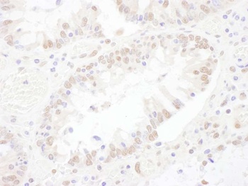 Rabbit anti-SNRNP200 Antibody