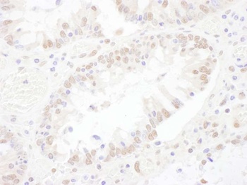 SNRNP200 Antibody