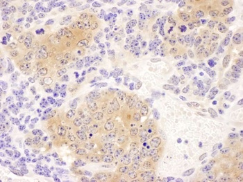 Rabbit CCT8 Antibody