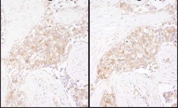 Rabbit anti-TCP1 Antibody