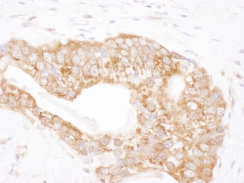 Rabbit anti-TCP1 Antibody