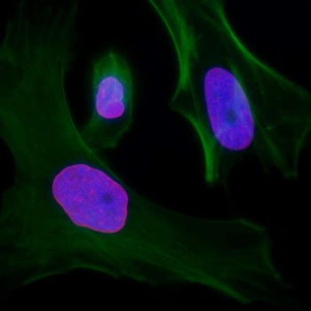 Rabbit anti-Lamin-A Antibody